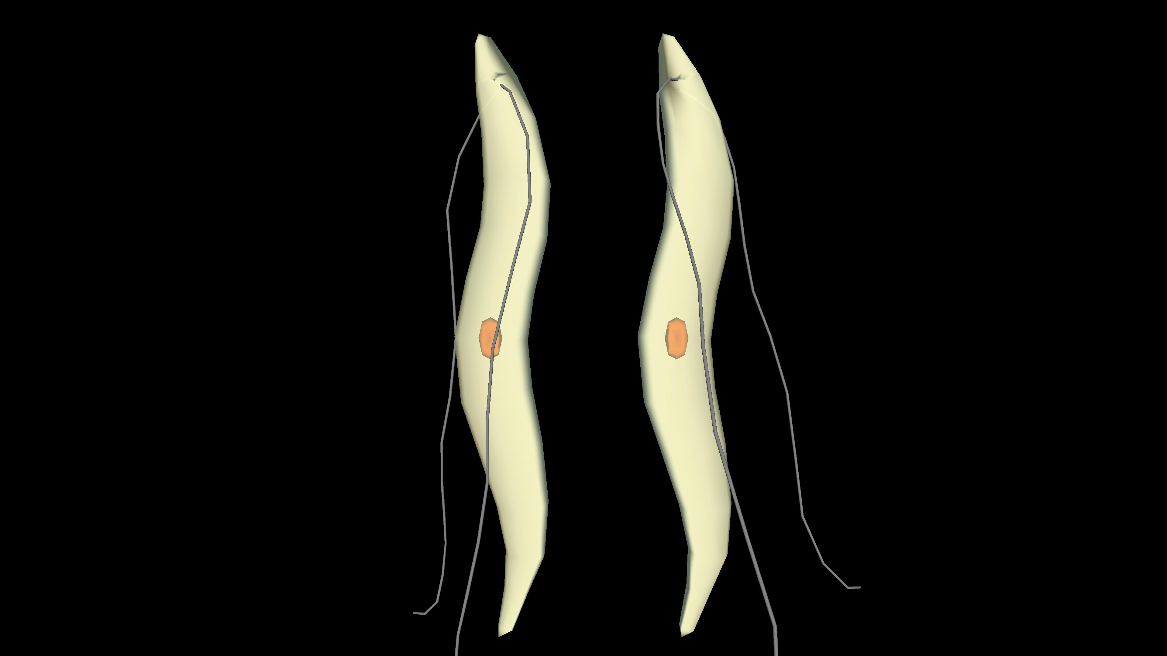 Binary fission in Leishmania
